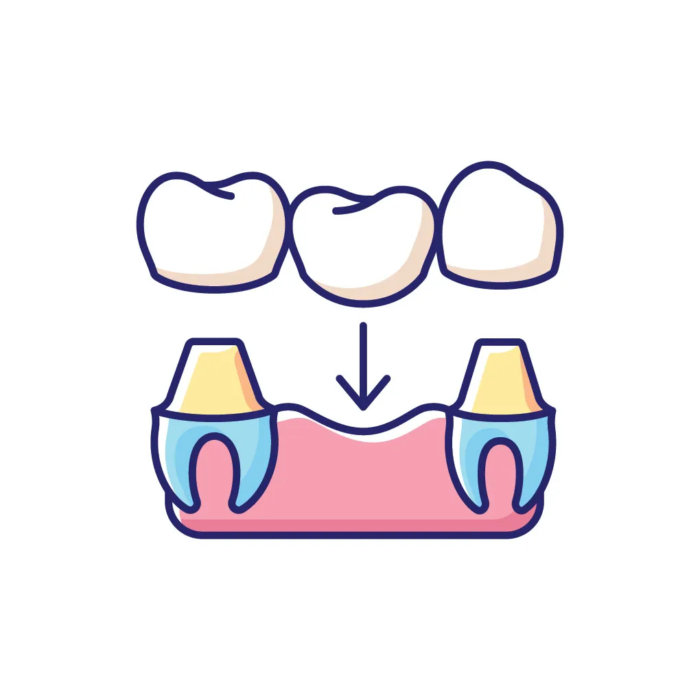 Dental Crowns & Bridges