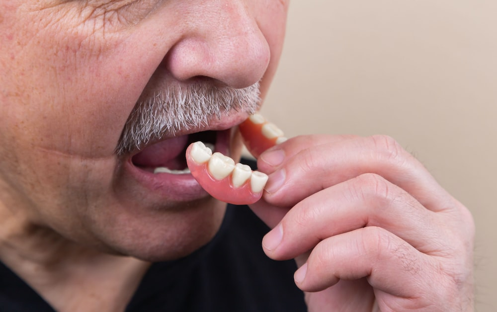 A man inserting removable dentures
