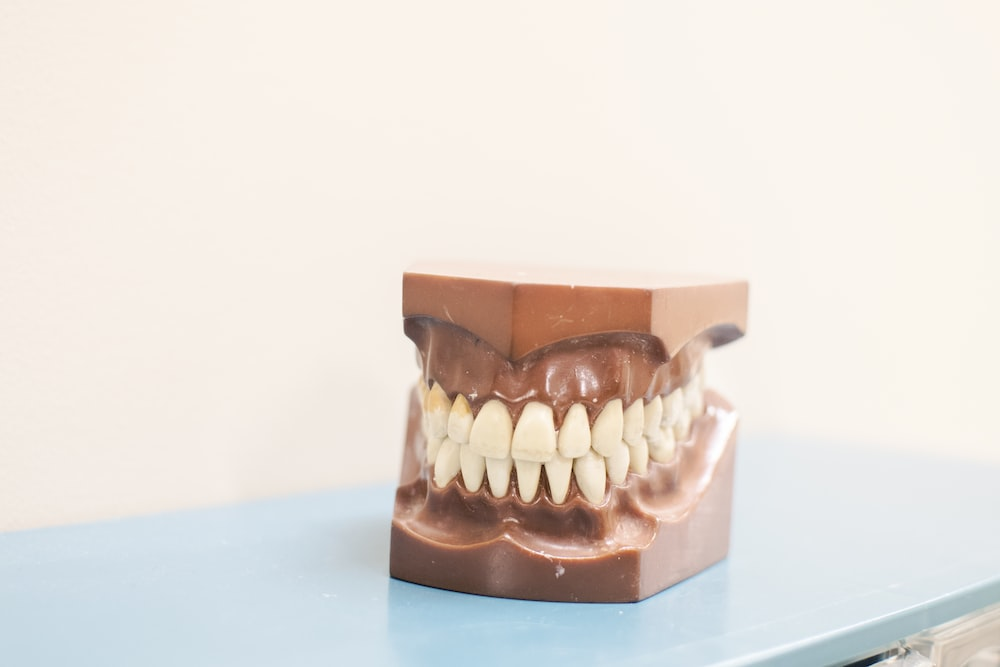 An image showing an artificial jaw with an overbite issue