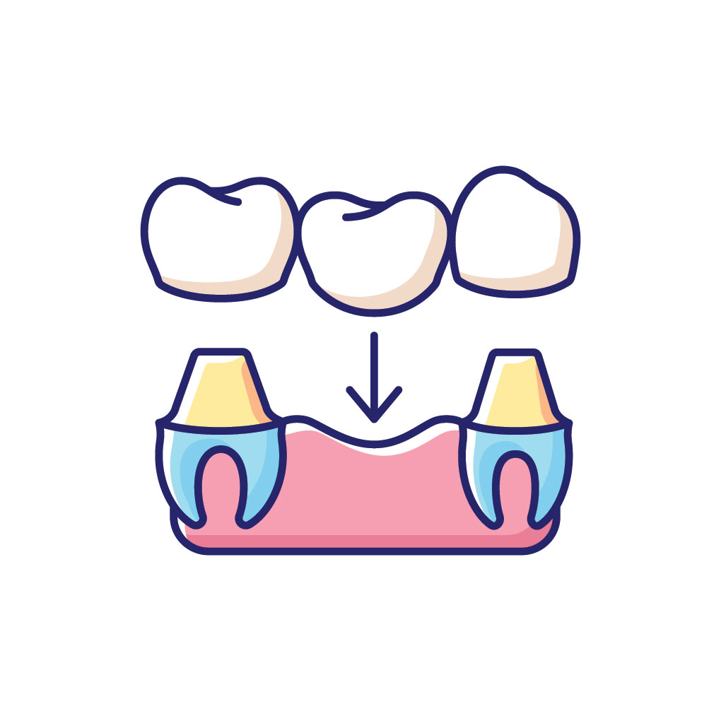 Dental Crowns & Bridges Dental Crowns & Bridges